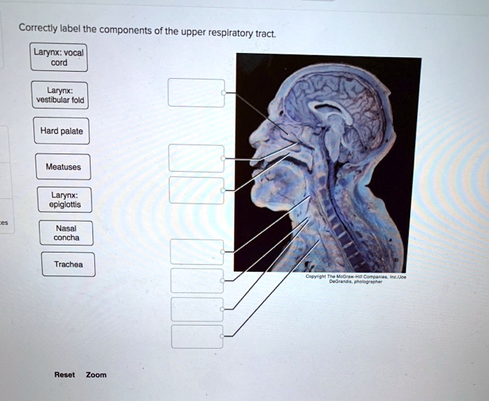 Correctly label the components of the upper respiratory tract.