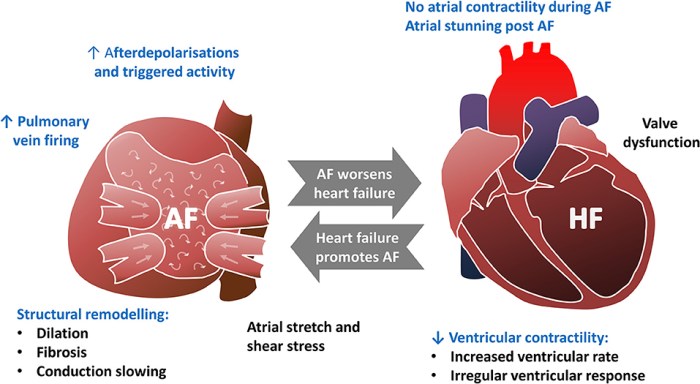 Heart failure with atrial fibrillation hesi case study