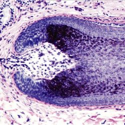 Label the structures associated with a hair follicle.